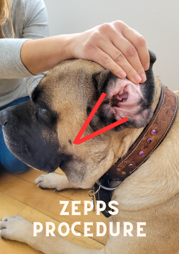 zepps procedure  